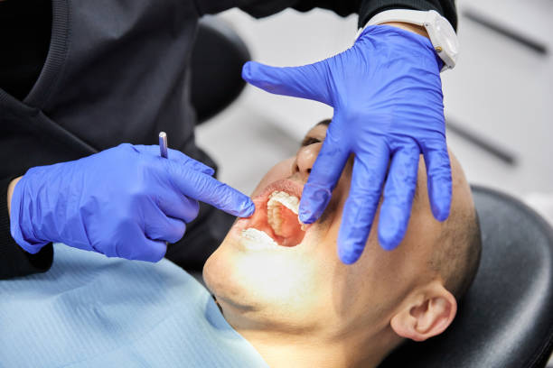 Best Emergency Treatment for Dental Infections or Abscesses in Culver, OR